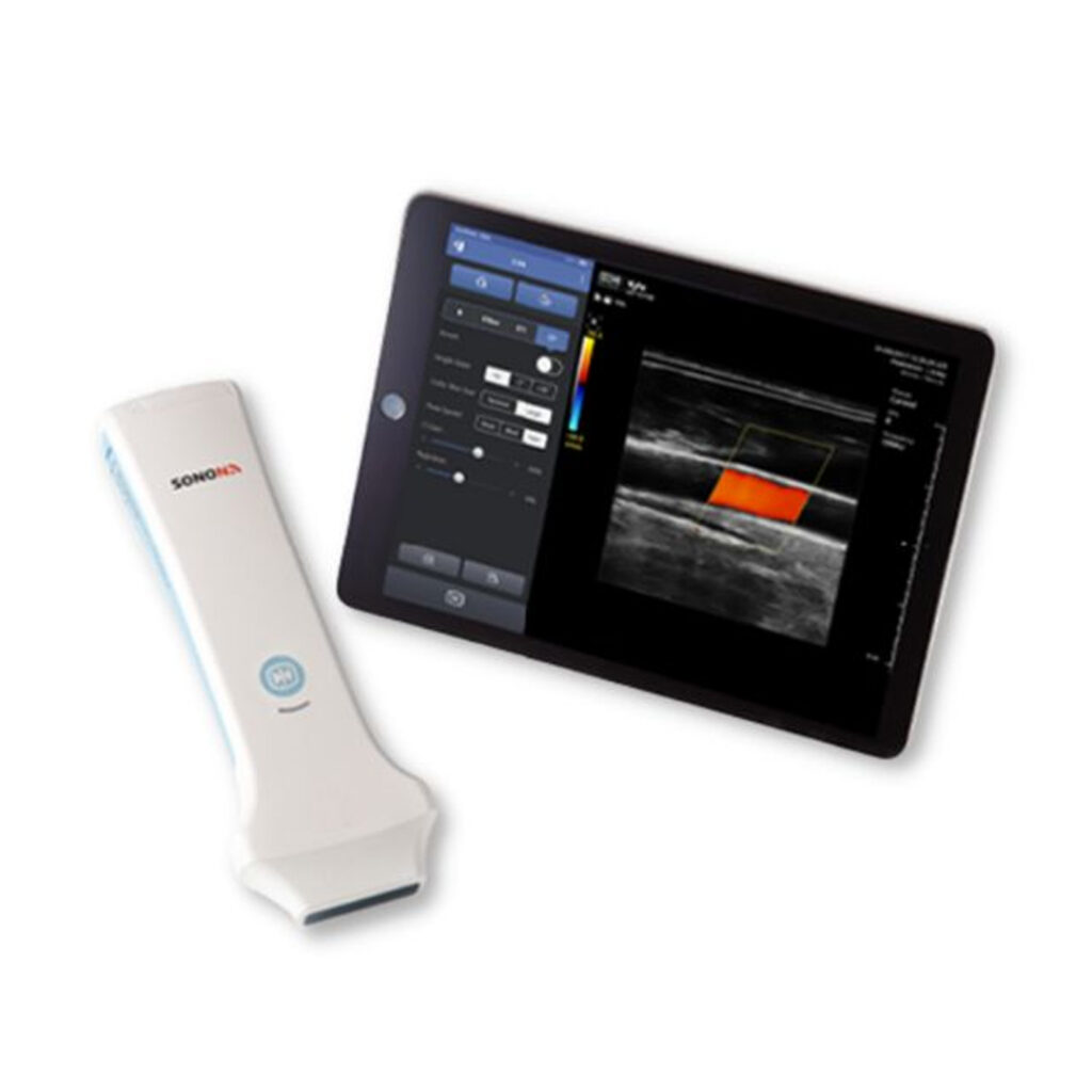 SONON-300L--Wireless-Handheld-Ultrasound