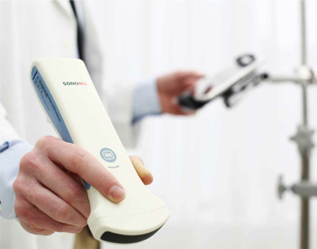 Sonon 300C | Wireless Handheld Ultrasound – Spec Brite Group