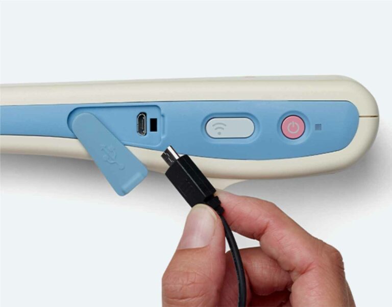 Sonon-300C-Wireless-ultrasound-device-long-battery
