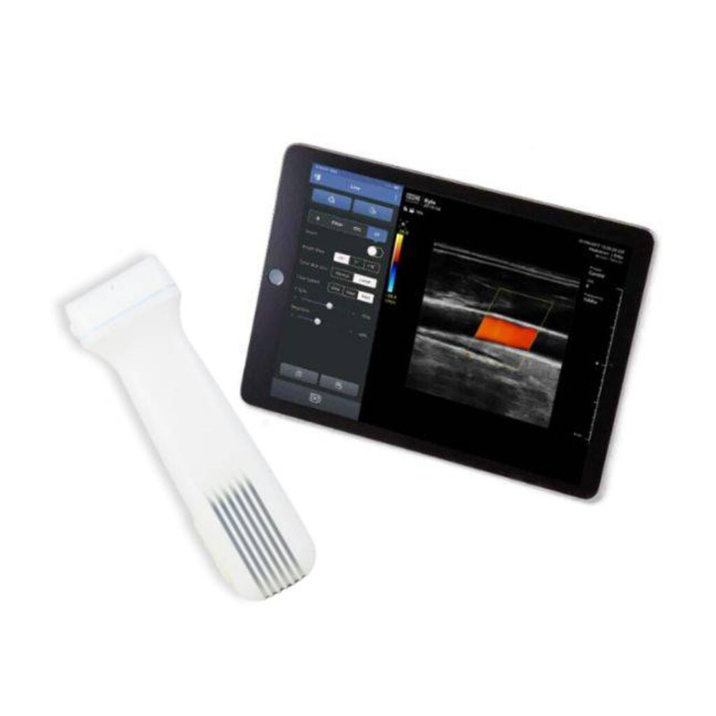 Sonon-500L--Wireless-Handheld-Ultrasound