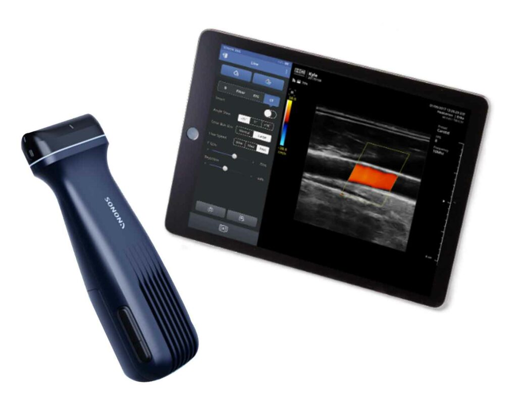 Sonon 500L Wireless Handheld Ultrasound Spec Brite Group