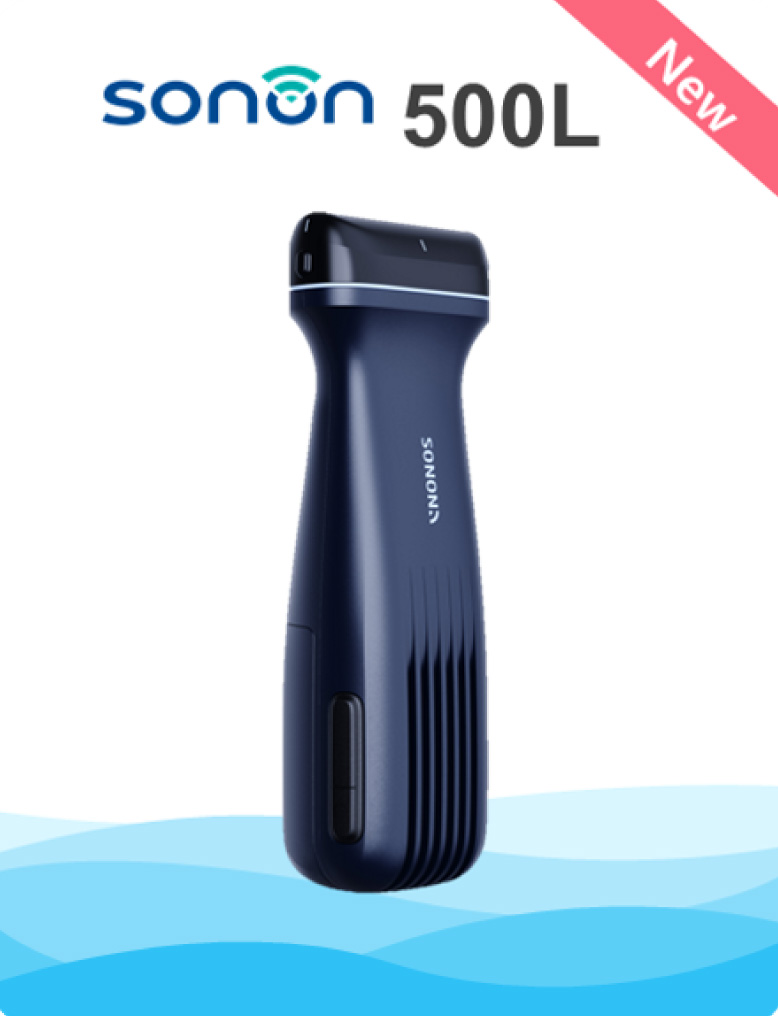 Sonon-500L-Wireless-ultrasound-device-new